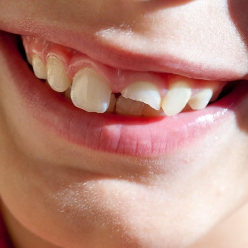 product_136464_1.jpg